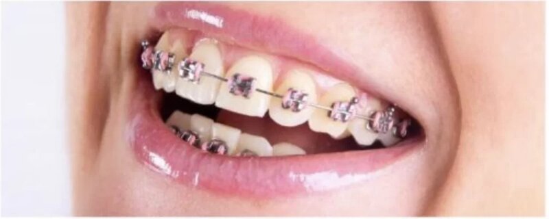 Cris Smile Studio - Clinica Stomatologica